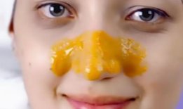 黑头视频,揭秘黑头成因及有效去除方法